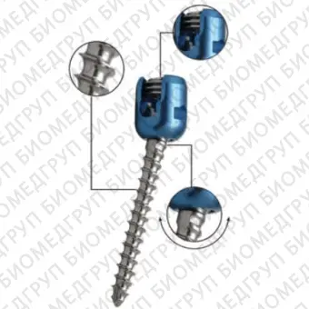 Транспедикулярный винт для поясничнокрестцового позвонка