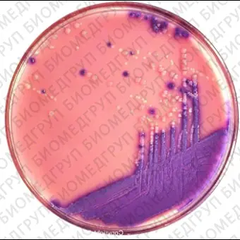 Escherichia coli