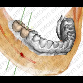 Программное обеспечение для стоматологии Invivo6