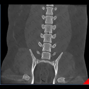 Ветеринарный сканер CBCT 5G XL