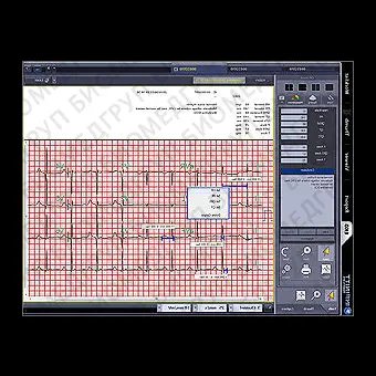 Система управления для анализа INFINITT EKG/ECG