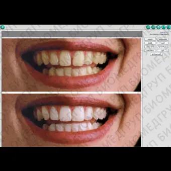 Программное обеспечение для обработки снимков зубов DEXIS