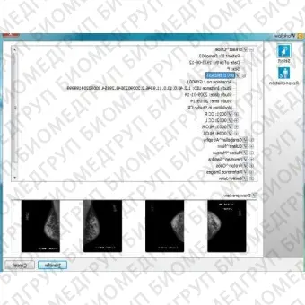 Медицинское программное обеспечение DICOMReader