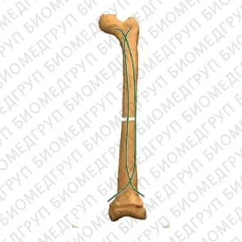 Интрамедуллярный штифт бедренная кость FLEX NAIL