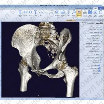 Программное обеспечение TDM mediCAD 3D Hip