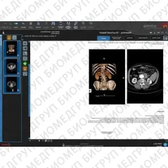 Программное обеспечение для медицинских снимков SUITESTENSA RIS PACS