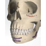Компрессионная костная пластина для челюстно-лицевого восстановления ORTRAUTEK Trauma 2.0