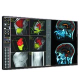 Double Black Imaging 42″ Professional LCD Медицинский монитор
